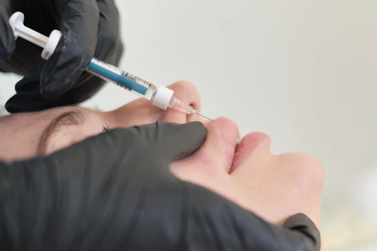 Dermal Fillers
