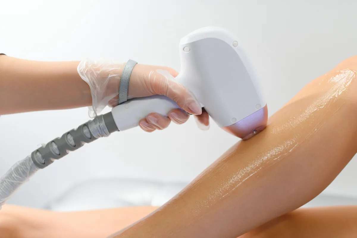 Laser Hair Removal