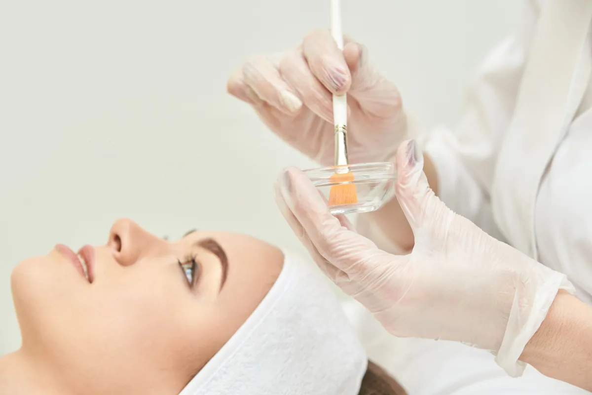 Facial Peels