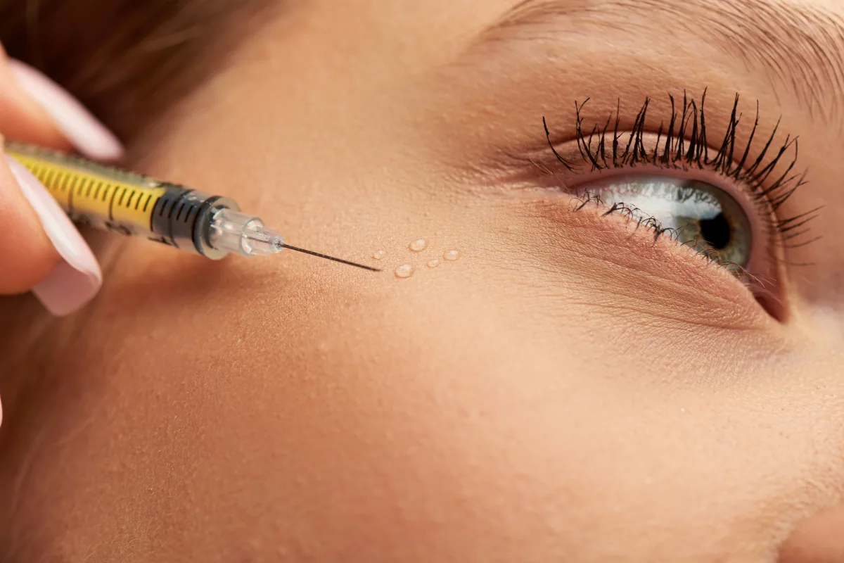 PRP: Platelet-Rich Plasma